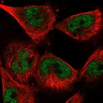 Atlas Antibodies Anti-SNRPA Antibody