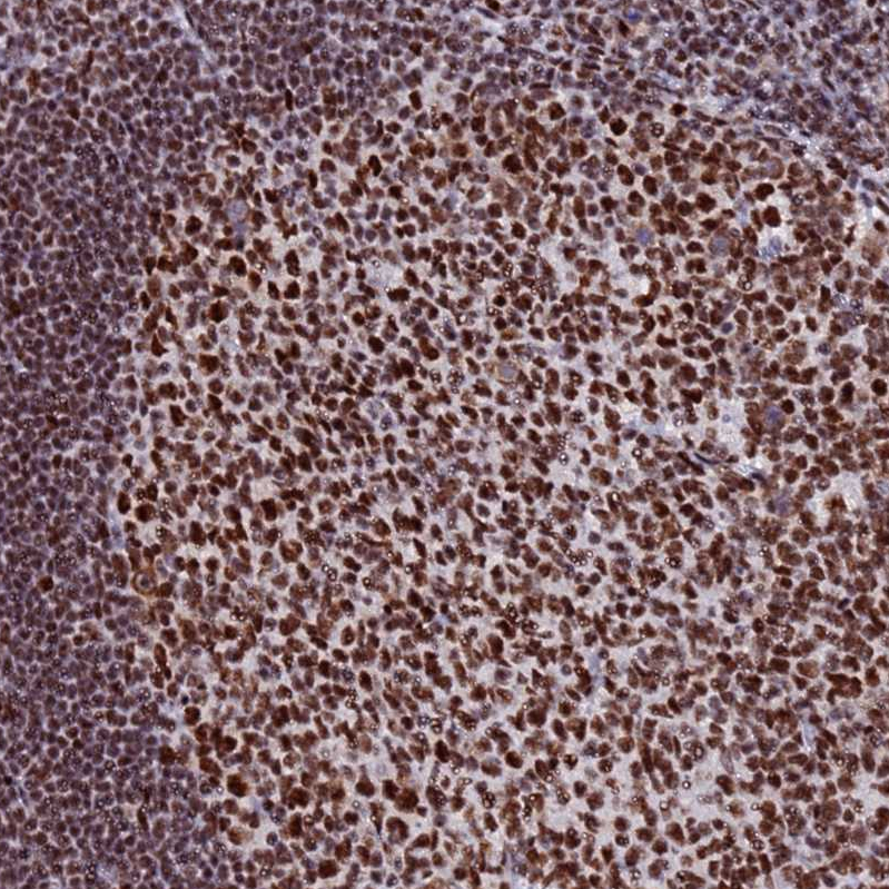 Atlas Antibodies Anti-SNRPA1 Antibody