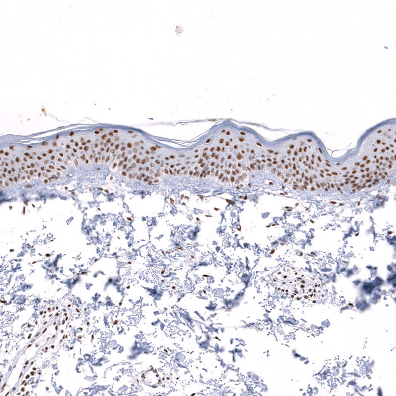 Atlas Antibodies Anti-SNRPB Antibody