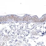 Atlas Antibodies Anti-SNRPB Antibody