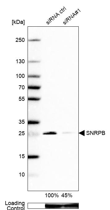 Atlas Antibodies Anti-SNRPB Antibody