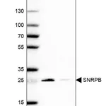 Atlas Antibodies Anti-SNRPB Antibody