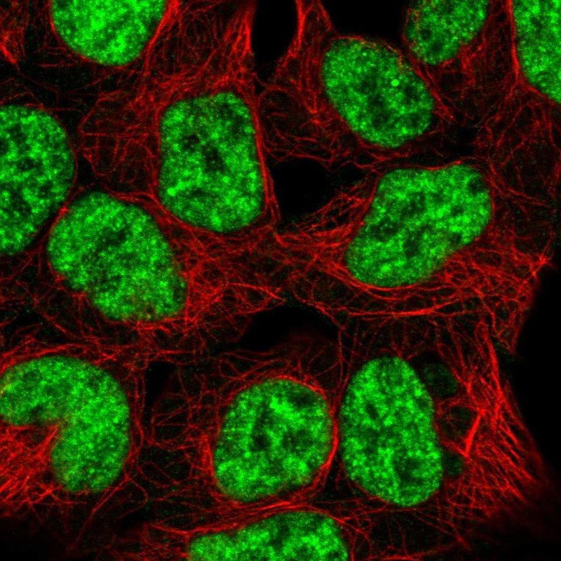 Atlas Antibodies Anti-SNRPB2 Antibody