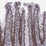 Atlas Antibodies Anti-SNRPB2 Antibody