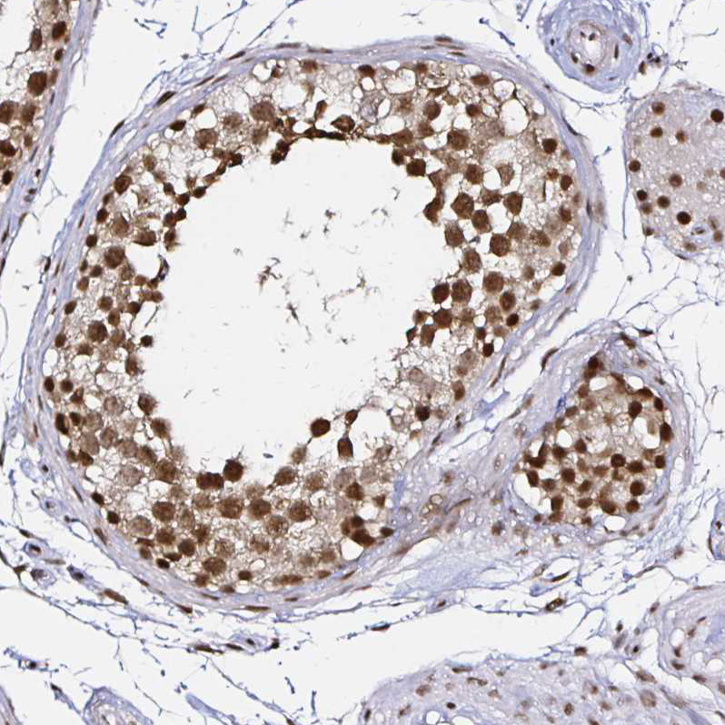 Atlas Antibodies Anti-SNRPC Antibody