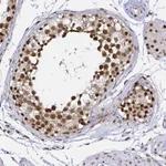 Atlas Antibodies Anti-SNRPC Antibody