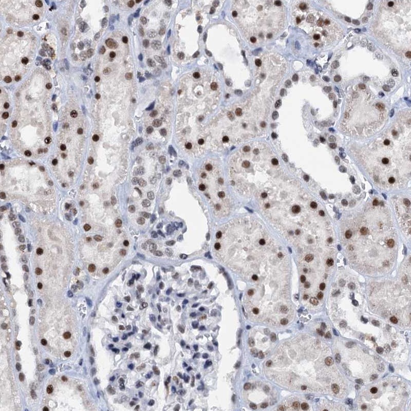 Atlas Antibodies Anti-SNRPD1 Antibody