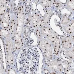 Atlas Antibodies Anti-SNRPD1 Antibody