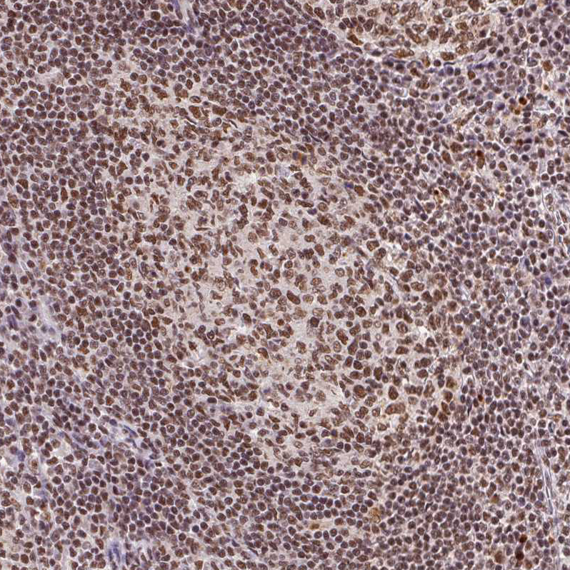 Atlas Antibodies Anti-SNRPG Antibody