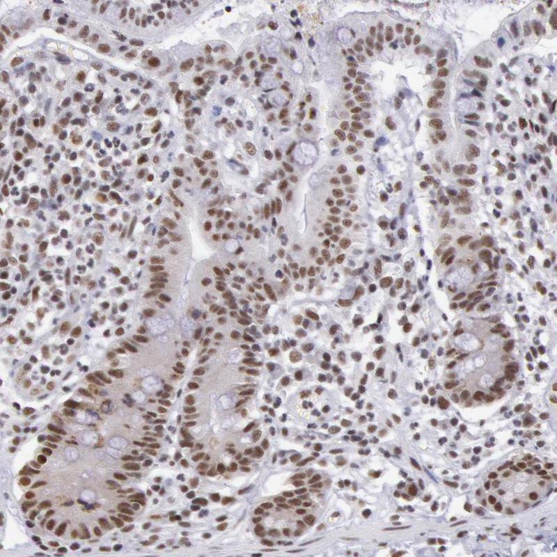 Atlas Antibodies Anti-SNRPD3 Antibody