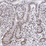 Atlas Antibodies Anti-SNRPD3 Antibody