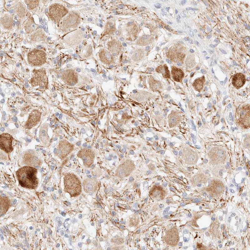 Atlas Antibodies Anti-SNTB1 Antibody