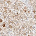 Atlas Antibodies Anti-SNTB1 Antibody