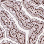 Atlas Antibodies Anti-SNRPD2 Antibody