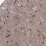 Atlas Antibodies Anti-SNTA1 Antibody