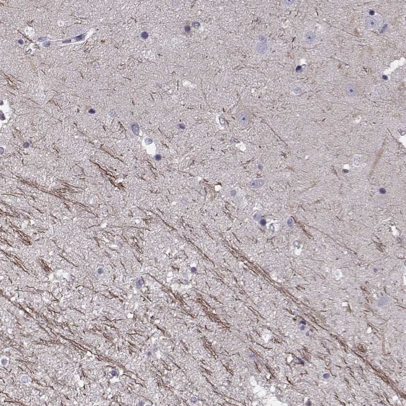 Atlas Antibodies Anti-SNTG1 Antibody