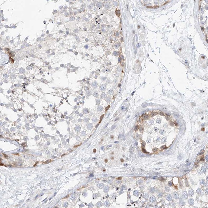 Atlas Antibodies Anti-SNU13 Antibody