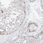 Atlas Antibodies Anti-SNU13 Antibody
