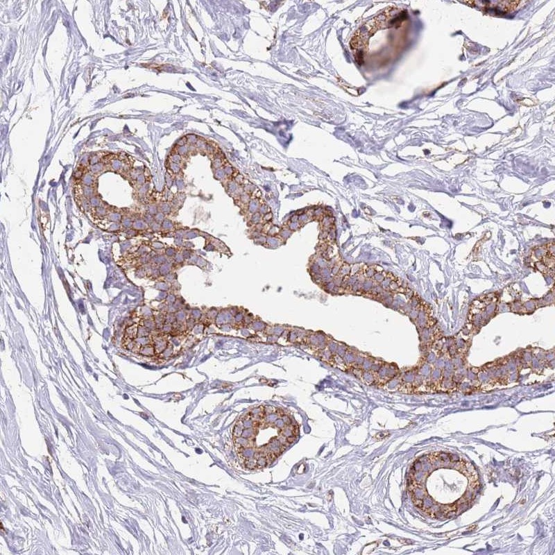 Atlas Antibodies Anti-SNX1 Antibody