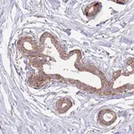 Atlas Antibodies Anti-SNX1 Antibody