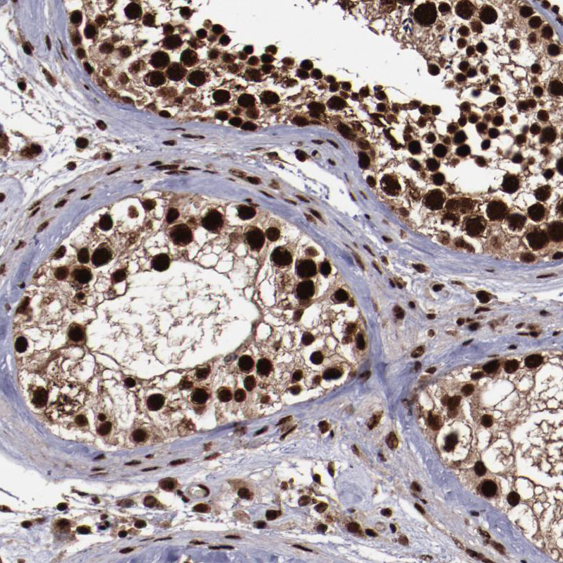 Atlas Antibodies Anti-SNW1 Antibody