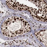 Atlas Antibodies Anti-SNW1 Antibody