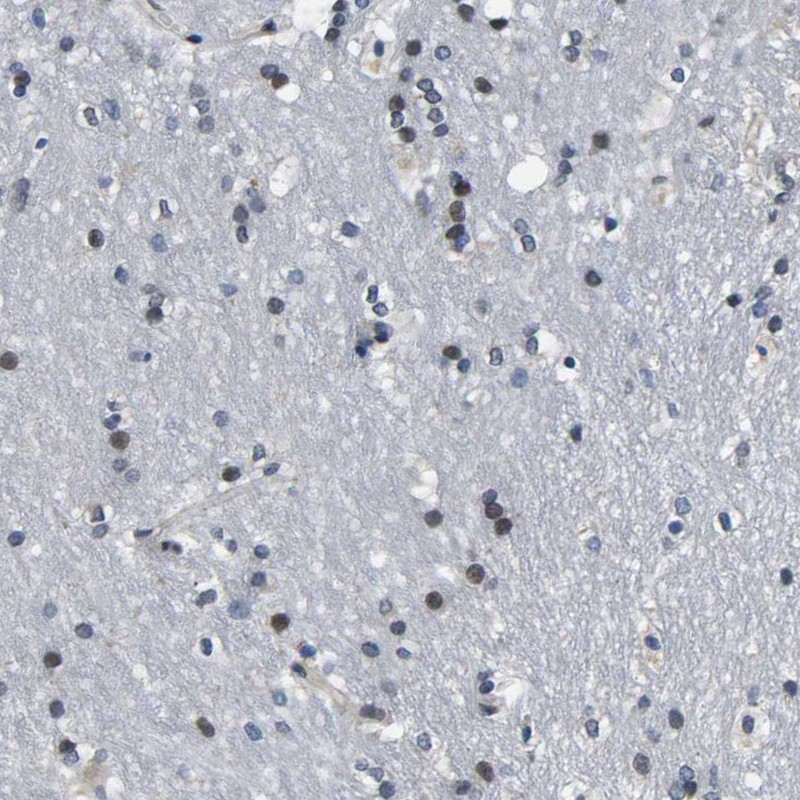 Atlas Antibodies Anti-SNX10 Antibody