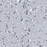 Atlas Antibodies Anti-SNX10 Antibody
