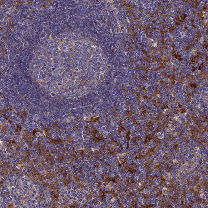 Atlas Antibodies Anti-SNX11 Antibody