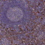Atlas Antibodies Anti-SNX11 Antibody