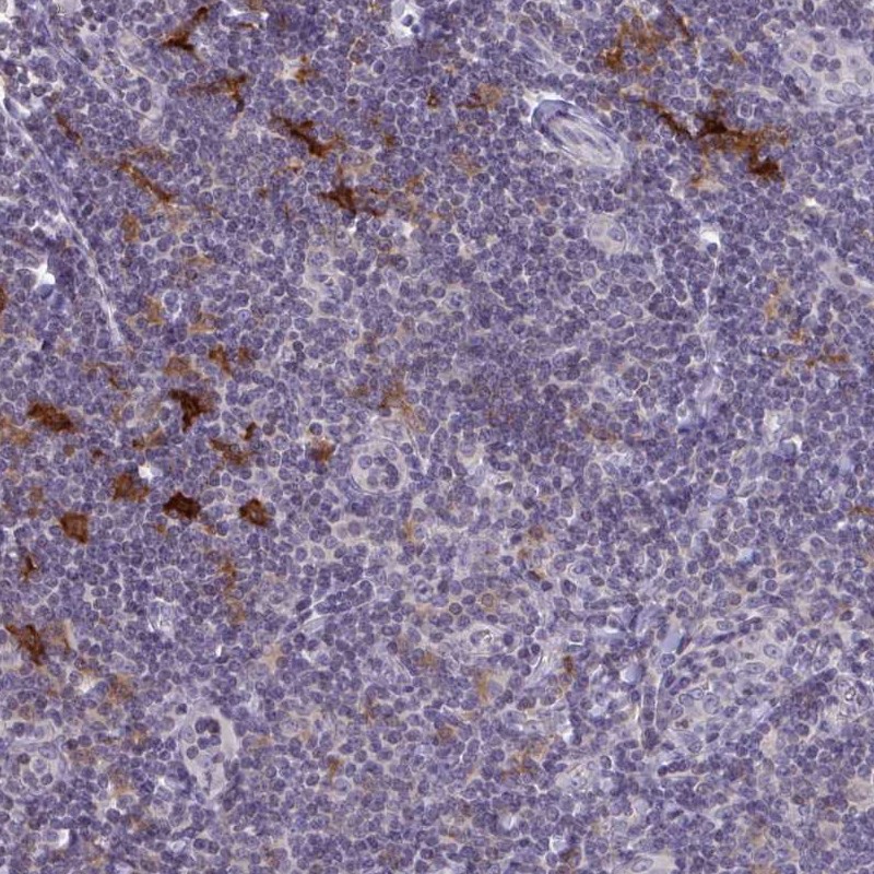 Atlas Antibodies Anti-SNX11 Antibody