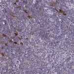 Atlas Antibodies Anti-SNX11 Antibody