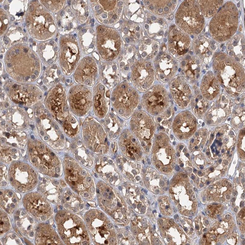 Atlas Antibodies Anti-SNX15 Antibody