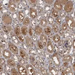 Atlas Antibodies Anti-SNX15 Antibody