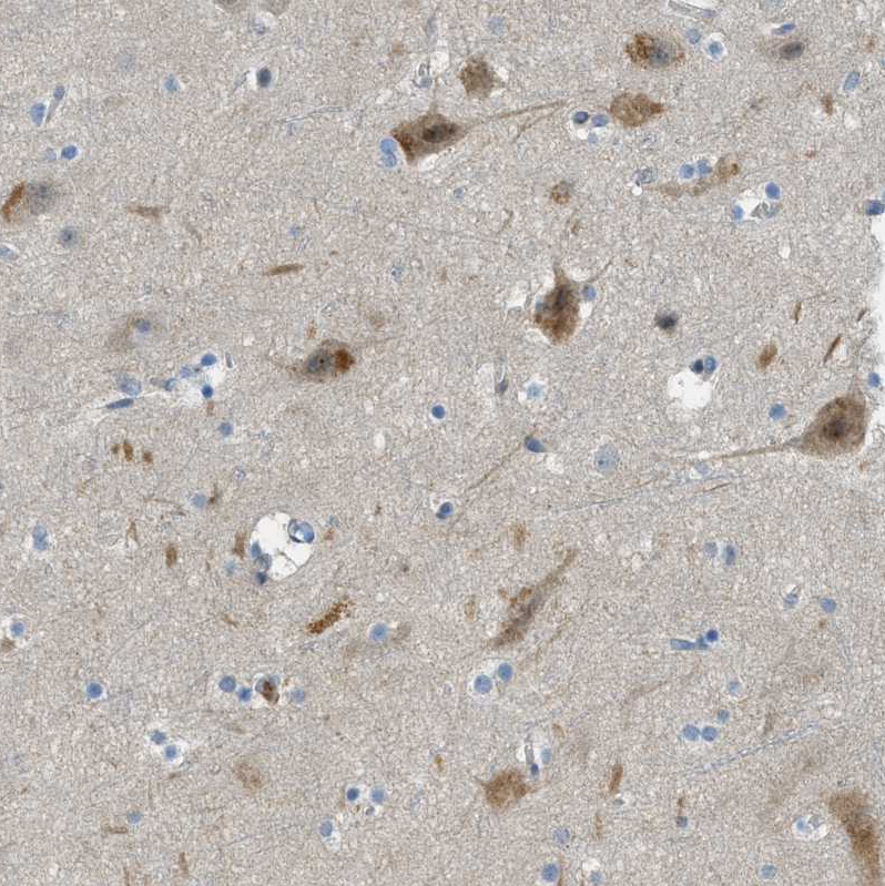 Atlas Antibodies Anti-SNX14 Antibody