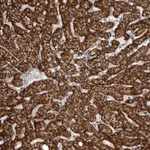 Atlas Antibodies Anti-SNX16 Antibody