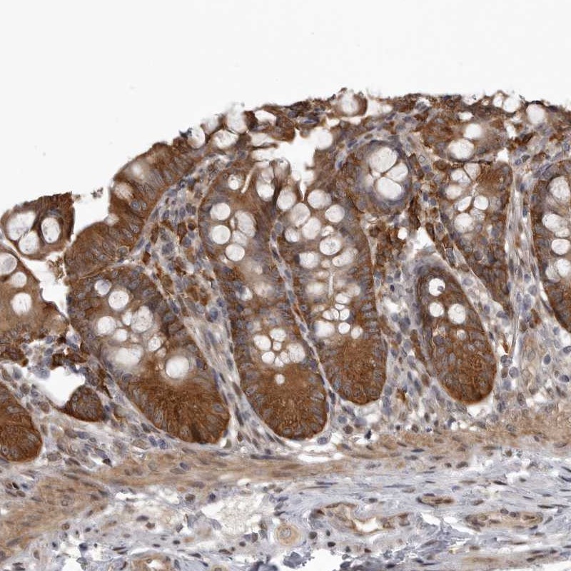 Atlas Antibodies Anti-SNX16 Antibody
