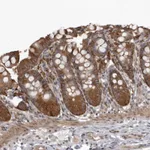 Atlas Antibodies Anti-SNX16 Antibody