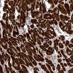 Atlas Antibodies Anti-SNX16 Antibody
