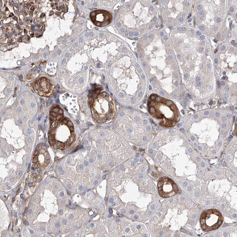 Atlas Antibodies Anti-SNX18 Antibody