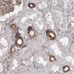 Atlas Antibodies Anti-SNX18 Antibody