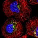 Atlas Antibodies Anti-SNX17 Antibody