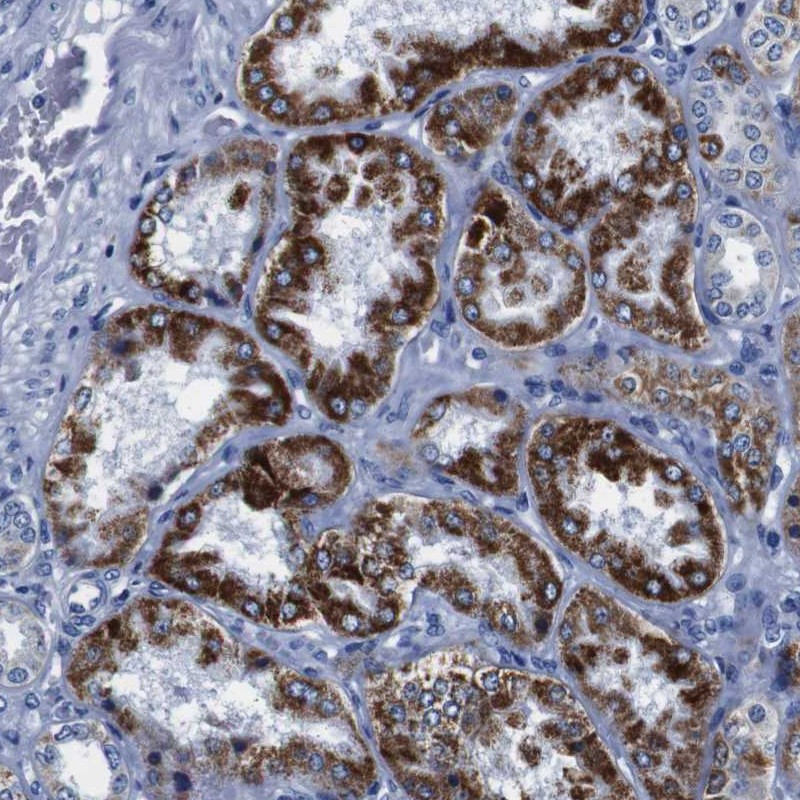 Atlas Antibodies Anti-SNX19 Antibody