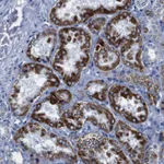 Atlas Antibodies Anti-SNX19 Antibody
