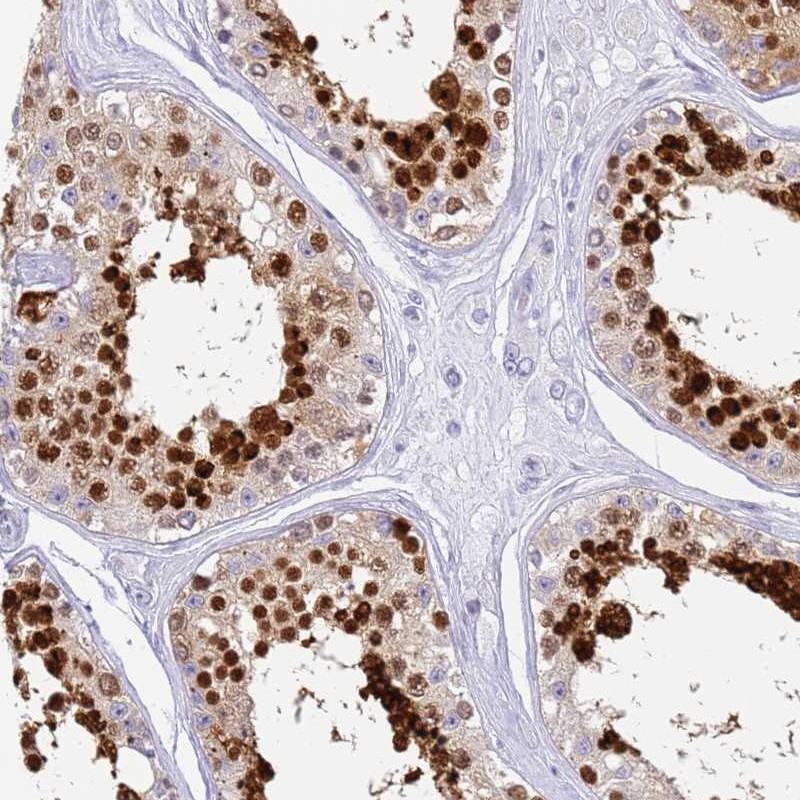 Atlas Antibodies Anti-SNX20 Antibody
