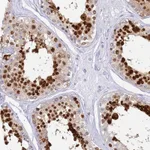 Atlas Antibodies Anti-SNX20 Antibody