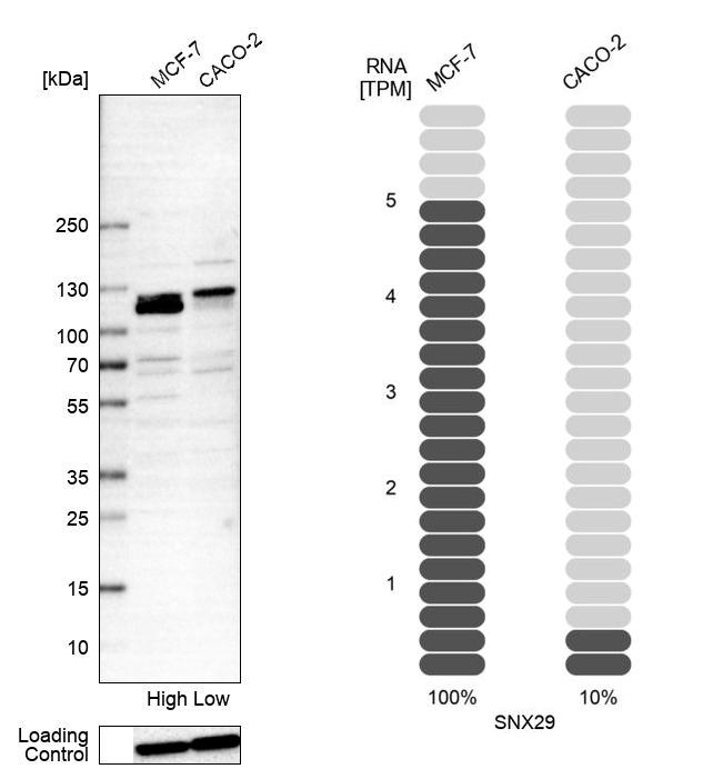 Atlas Antibodies Anti-SNX29 Antibody