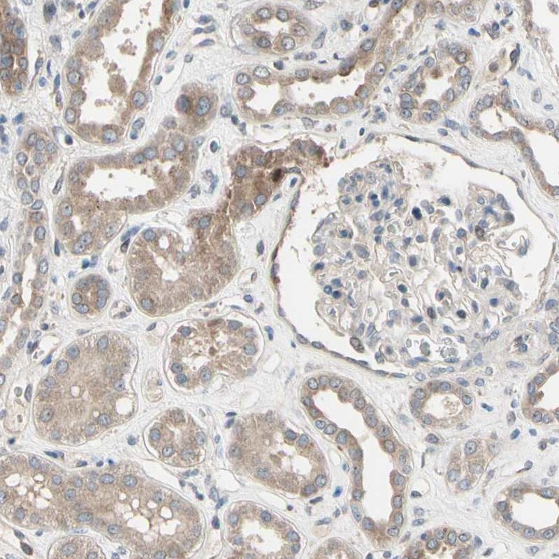 Atlas Antibodies Anti-SNX29 Antibody