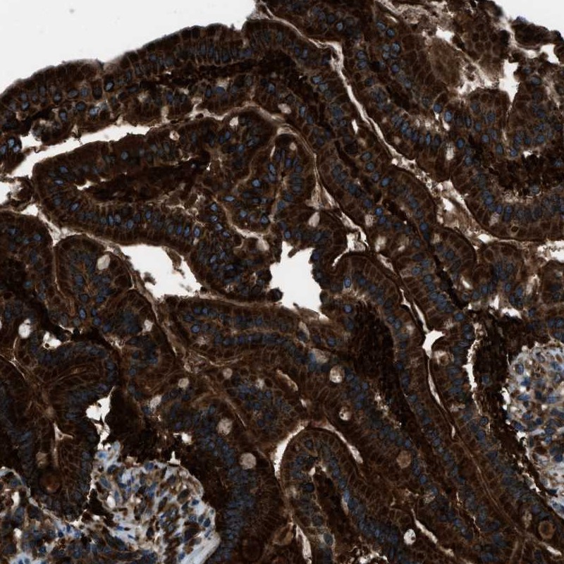 Atlas Antibodies Anti-SNX30 Antibody