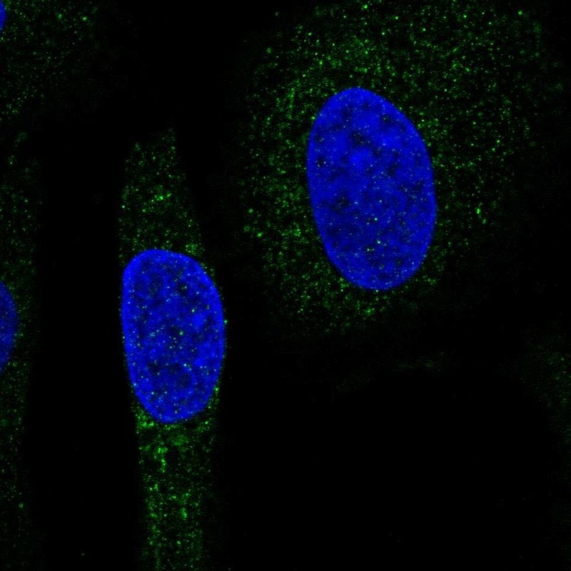 Atlas Antibodies Anti-SNX24 Antibody